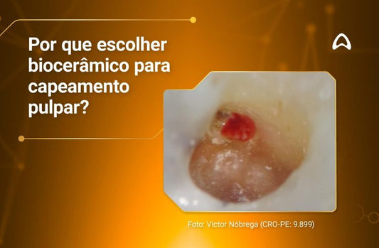 Pourquoi choisir les biocéramiques pour les procédures de coiffage de la pulpe ?