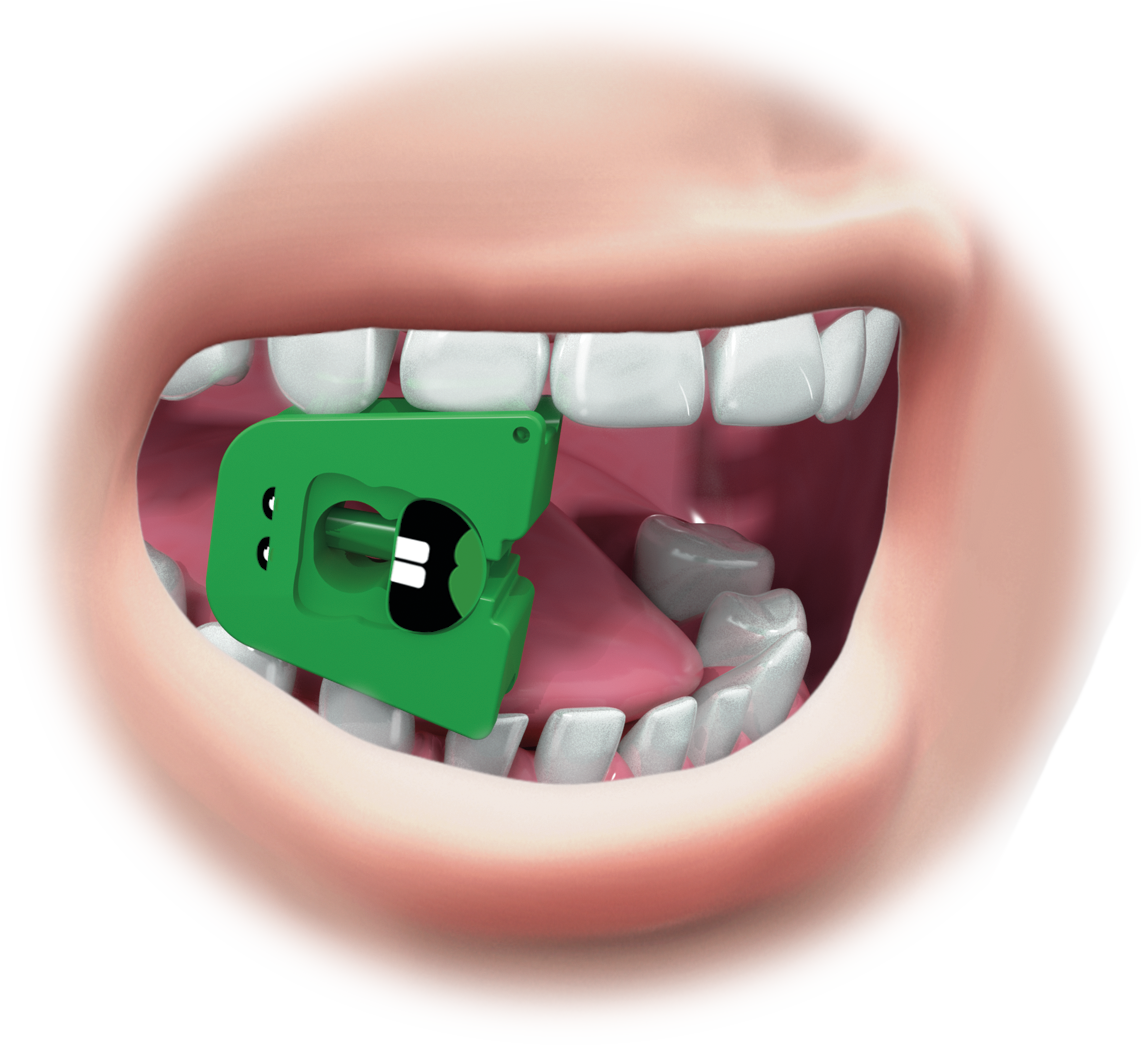 Mouth Rest - MTS Devices